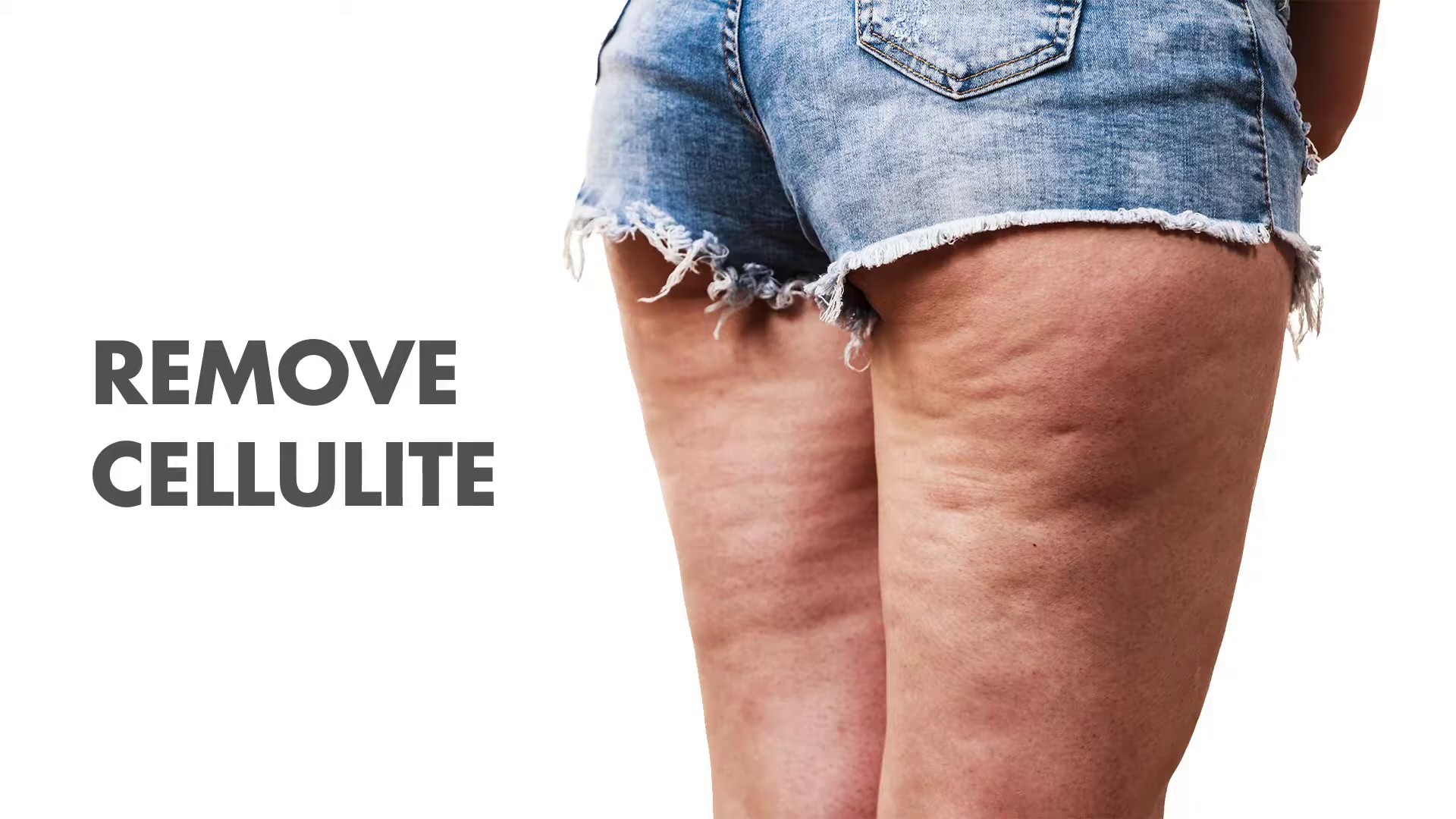 Cellulite elimination treatment