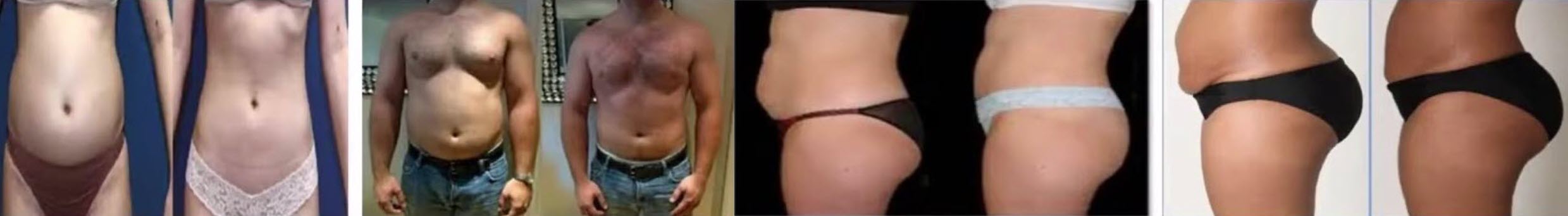 Before and after fat loss results with invisa-RED™