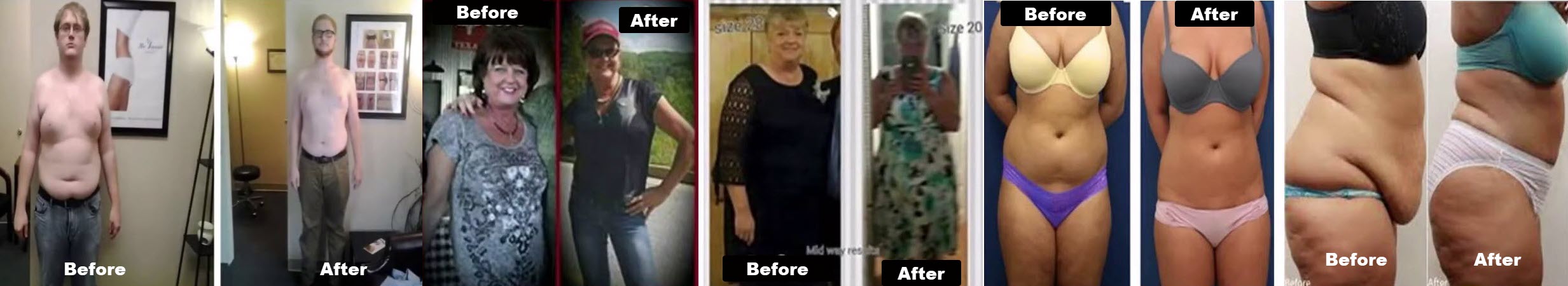 Patient transformation results before and after invisa-RED™ treatments
