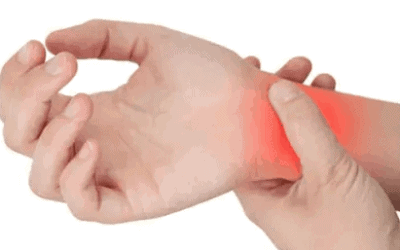 Carpal Tunnel Syndrome: What is it again?